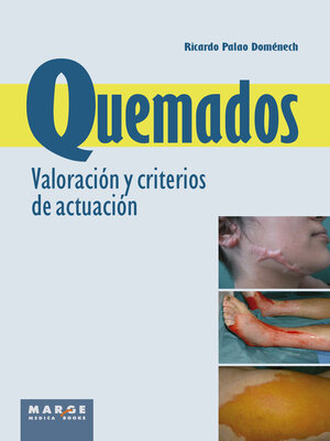 cover image of Quemados